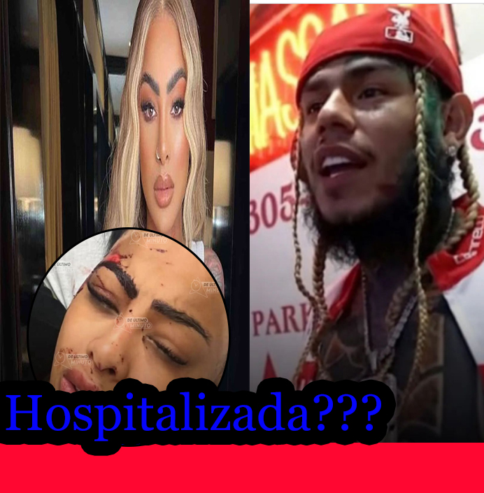 Tekashi atropello a Yaili?? y ella revela la verdad de lo sucedido